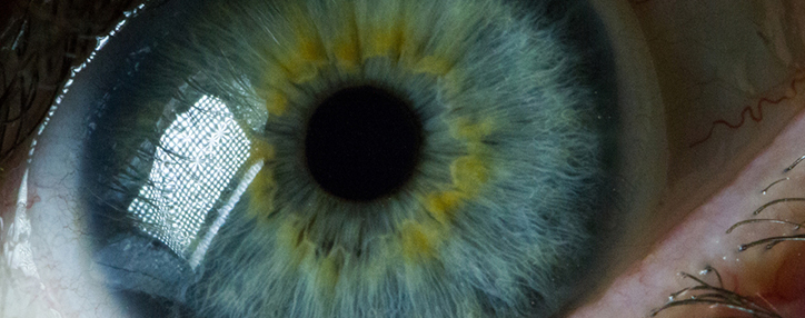 Google запатентовала электронные линзы, которые устанавливаются инъекцией в глаз